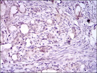 Anti-CD41 antibody [2E10C9] used in IHC (Paraffin sections) (IHC-P). GTX60763