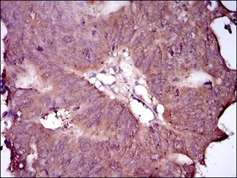 Anti-EGFR (mutant) antibody [5G9B5] used in IHC (Paraffin sections) (IHC-P). GTX60766