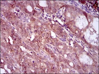 Anti-EGFR (mutant) antibody [5G9B5] used in IHC (Paraffin sections) (IHC-P). GTX60766