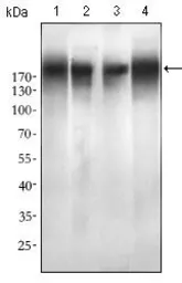 Anti-EGFR (mutant) antibody [5G9B5] used in Western Blot (WB). GTX60766