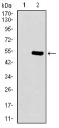 Anti-EGFR (mutant) antibody [5G9B5] used in Western Blot (WB). GTX60766