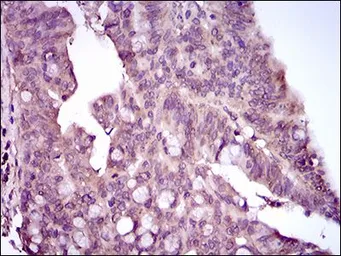 Anti-p38 MAPK antibody [8G4D11] used in IHC (Paraffin sections) (IHC-P). GTX60771