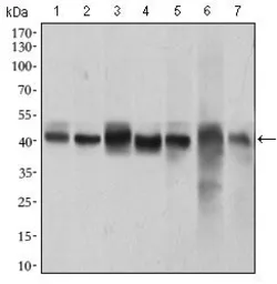 Anti-p38 MAPK antibody [8G4D11] used in Western Blot (WB). GTX60771