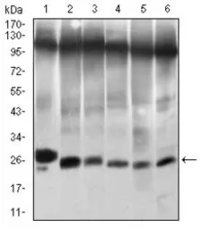 Anti-Twist1 antibody [10E4E6] used in Western Blot (WB). GTX60776