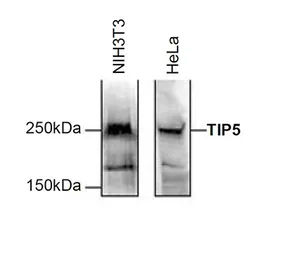 Anti-TIP-5 antibody - ChIP grade used in Western Blot (WB). GTX60851