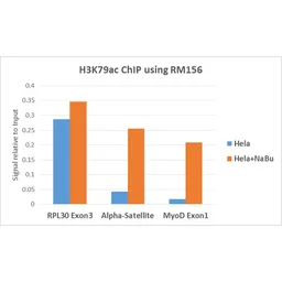 Anti-Histone H3K79ac (Acetyl Lys79) antibody [RM156] used in ChIP assay (ChIP assay). GTX60883