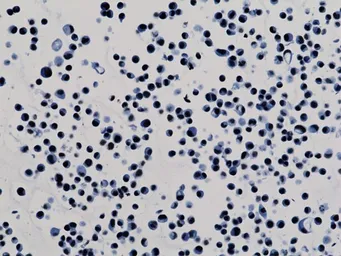 Anti-Histone H3K9ac (Acetyl Lys9) antibody [RM161] used in Immunocytochemistry/ Immunofluorescence (ICC/IF). GTX60885