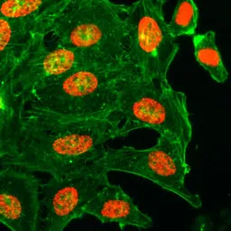 Anti-Histone H3K18ac (Acetyl Lys18) antibody [RM166] used in Immunocytochemistry/ Immunofluorescence (ICC/IF). GTX60886