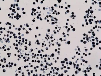 Anti-Histone H3K27me3 (Tri-methyl Lys27) antibody [RM175] used in Immunocytochemistry/ Immunofluorescence (ICC/IF). GTX60892