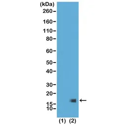 Anti-Histone H3K27me3 (Tri-methyl Lys27) antibody [RM175] used in Western Blot (WB). GTX60892