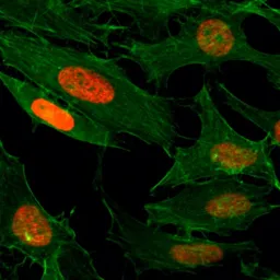 Anti-Histone H3K4ac (Acetyl Lys4) antibody [RM149] used in Immunocytochemistry/ Immunofluorescence (ICC/IF). GTX60893