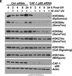 Anti-Histone H3K56ac (Acetyl Lys56) antibody [RM179] used in Western Blot (WB). GTX60902