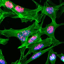 Anti-Histone H3K23ac (Aceyl Lys23) antibody [RM169] used in Immunocytochemistry/ Immunofluorescence (ICC/IF). GTX60911
