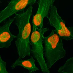 Anti-Histone H2A.Z antibody [RM215] used in Immunocytochemistry/ Immunofluorescence (ICC/IF). GTX60915