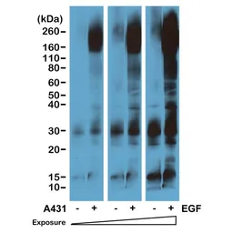 Anti-Phosphotyrosine antibody [RM111] used in Western Blot (WB). GTX60918