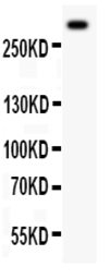 Anti-VWF antibody used in Western Blot (WB). GTX60934