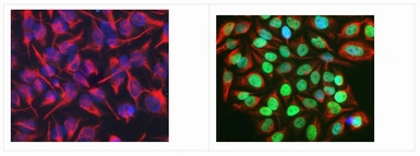 Anti-c-Fos antibody [2H2] used in Immunocytochemistry/ Immunofluorescence (ICC/IF). GTX60996