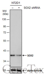 Anti-SOX2 antibody [GT1876] used in Western Blot (WB). GTX627404
