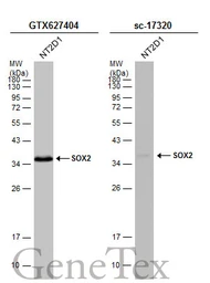 Anti-SOX2 antibody [GT1876] used in Western Blot (WB). GTX627404