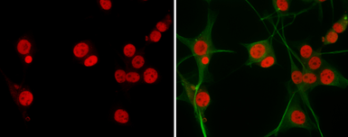 Anti-SOX2 antibody [GT1352] used in Immunocytochemistry/ Immunofluorescence (ICC/IF). GTX627405