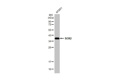 Anti-SOX2 antibody [GT1352] used in Western Blot (WB). GTX627405