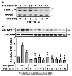 Anti-GAPDH antibody [GT239] used in Western Blot (WB). GTX627408