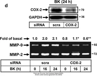Anti-GAPDH antibody [GT239] used in Western Blot (WB). GTX627408
