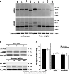 Anti-GAPDH antibody [GT239] used in Western Blot (WB). GTX627408