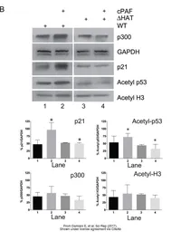 Anti-GAPDH antibody [GT239] used in Western Blot (WB). GTX627408