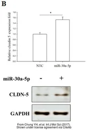Anti-GAPDH antibody [GT239] used in Western Blot (WB). GTX627408