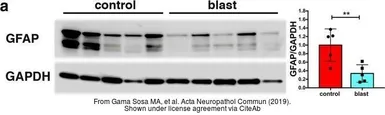 Anti-GAPDH antibody [GT239] used in Western Blot (WB). GTX627408
