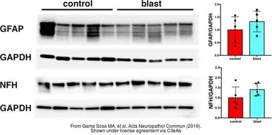 Anti-GAPDH antibody [GT239] used in Western Blot (WB). GTX627408