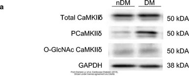Anti-GAPDH antibody [GT239] used in Western Blot (WB). GTX627408