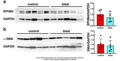 Anti-GAPDH antibody [GT239] used in Western Blot (WB). GTX627408