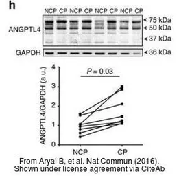 Anti-GAPDH antibody [GT239] used in Western Blot (WB). GTX627408