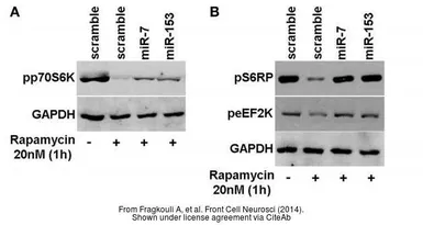 Anti-GAPDH antibody [GT239] used in Western Blot (WB). GTX627408