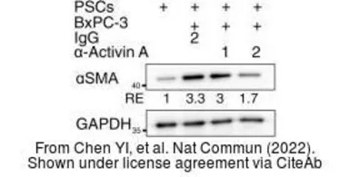 Anti-GAPDH antibody [GT239] used in Western Blot (WB). GTX627408