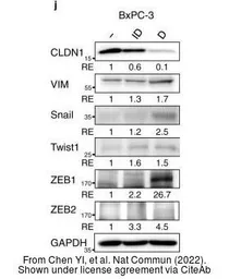 Anti-GAPDH antibody [GT239] used in Western Blot (WB). GTX627408