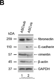 Anti-GAPDH antibody [GT239] used in Western Blot (WB). GTX627408