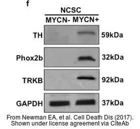 Anti-GAPDH antibody [GT239] used in Western Blot (WB). GTX627408