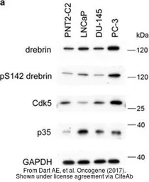 Anti-GAPDH antibody [GT239] used in Western Blot (WB). GTX627408