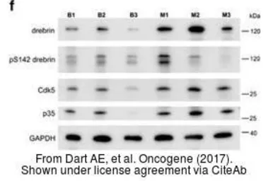 Anti-GAPDH antibody [GT239] used in Western Blot (WB). GTX627408