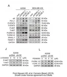 Anti-GAPDH antibody [GT239] used in Western Blot (WB). GTX627408