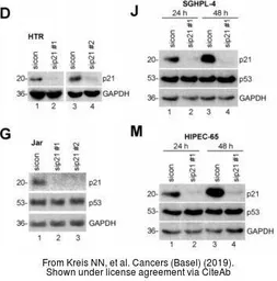 Anti-GAPDH antibody [GT239] used in Western Blot (WB). GTX627408