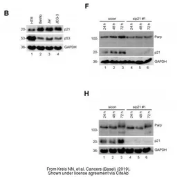 Anti-GAPDH antibody [GT239] used in Western Blot (WB). GTX627408