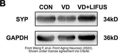 Anti-GAPDH antibody [GT239] used in Western Blot (WB). GTX627408