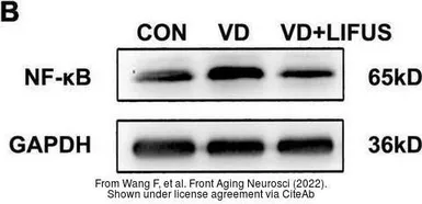 Anti-GAPDH antibody [GT239] used in Western Blot (WB). GTX627408