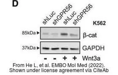 Anti-GAPDH antibody [GT239] used in Western Blot (WB). GTX627408