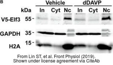 Anti-GAPDH antibody [GT239] used in Western Blot (WB). GTX627408