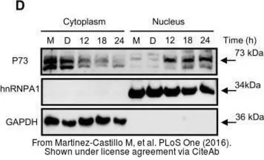 Anti-GAPDH antibody [GT239] used in Western Blot (WB). GTX627408